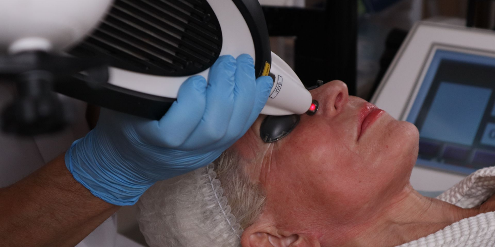 Rajeunissement et lifting de la peau (RecoSMA® sur la plateforme MULTILINE™)